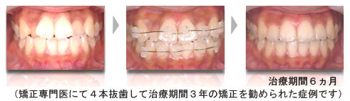 症例