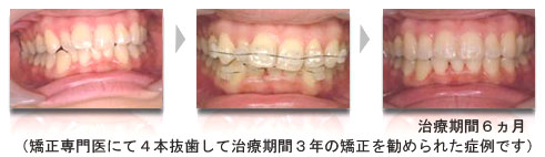 症例