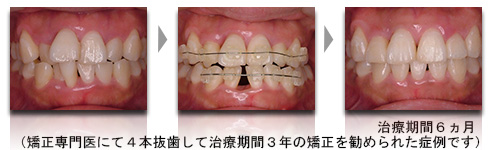 症例